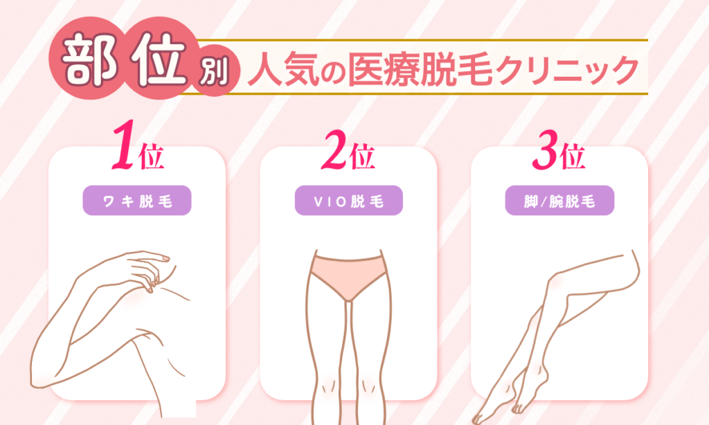 脱毛で人気の部位は1位ワキ脱毛 2位VIO脱毛 3位脚/腕脱毛